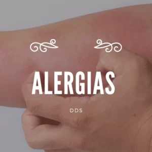 O que são Alergias? – DDS